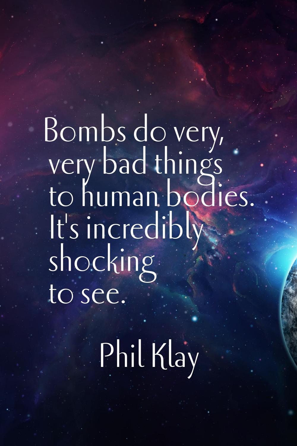 Bombs do very, very bad things to human bodies. It's incredibly shocking to see.