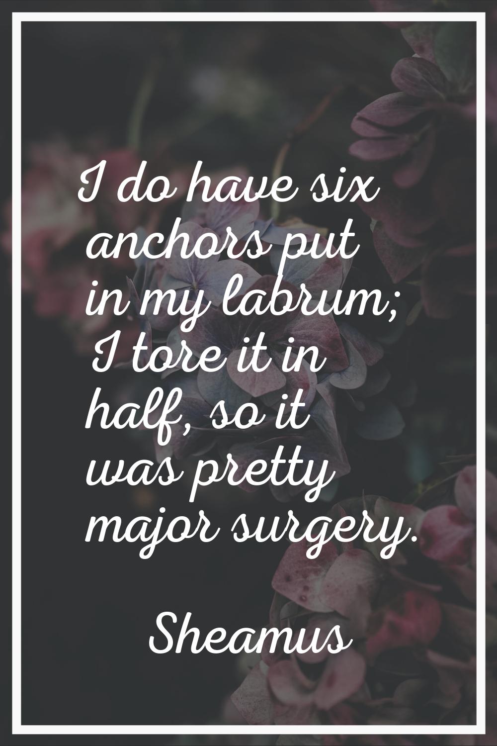 I do have six anchors put in my labrum; I tore it in half, so it was pretty major surgery.