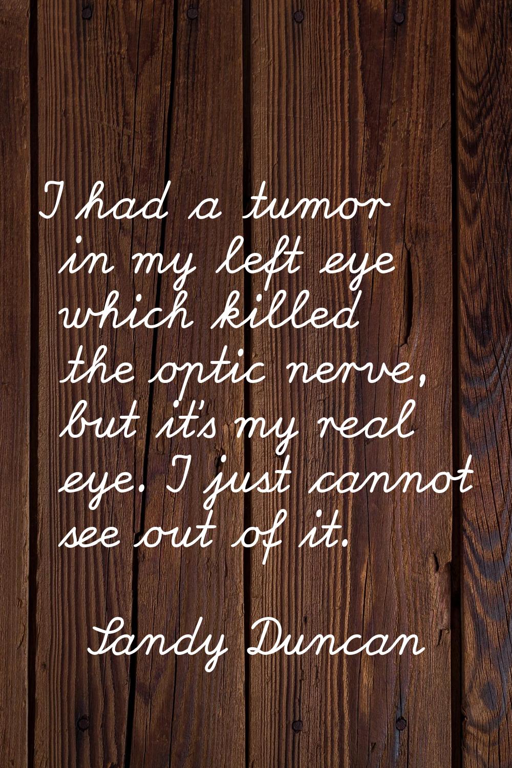 I had a tumor in my left eye which killed the optic nerve, but it's my real eye. I just cannot see 