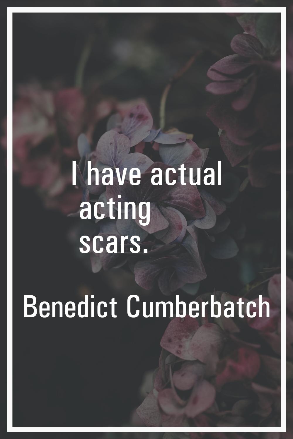 I have actual acting scars.
