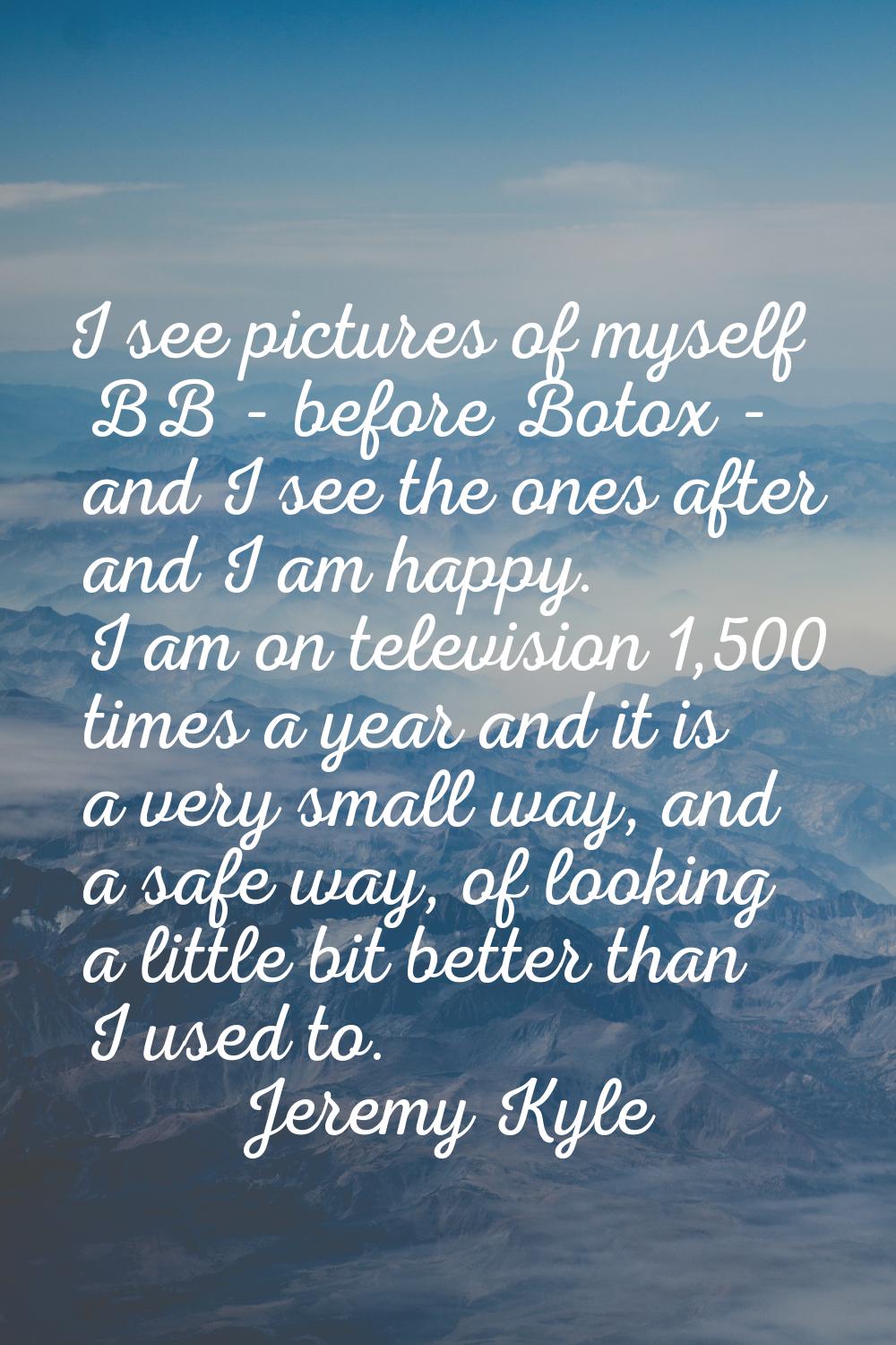 I see pictures of myself BB - before Botox - and I see the ones after and I am happy. I am on telev