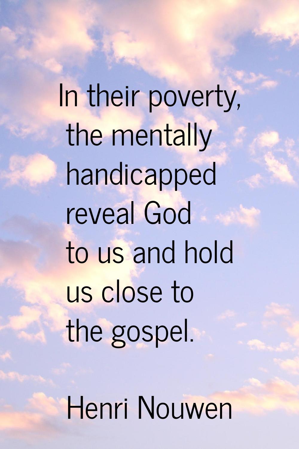 In their poverty, the mentally handicapped reveal God to us and hold us close to the gospel.