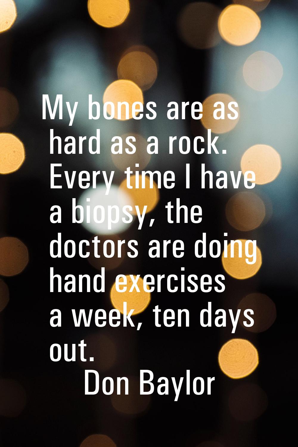 My bones are as hard as a rock. Every time I have a biopsy, the doctors are doing hand exercises a 