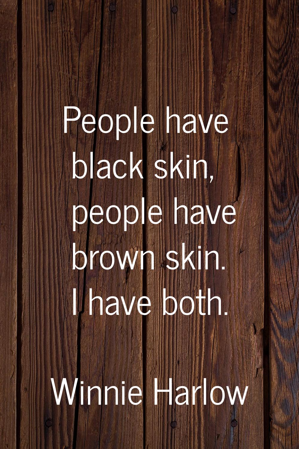 People have black skin, people have brown skin. I have both.