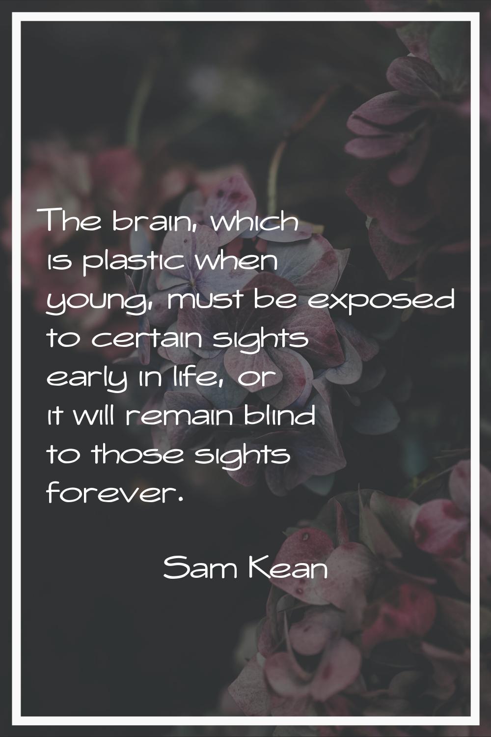 The brain, which is plastic when young, must be exposed to certain sights early in life, or it will