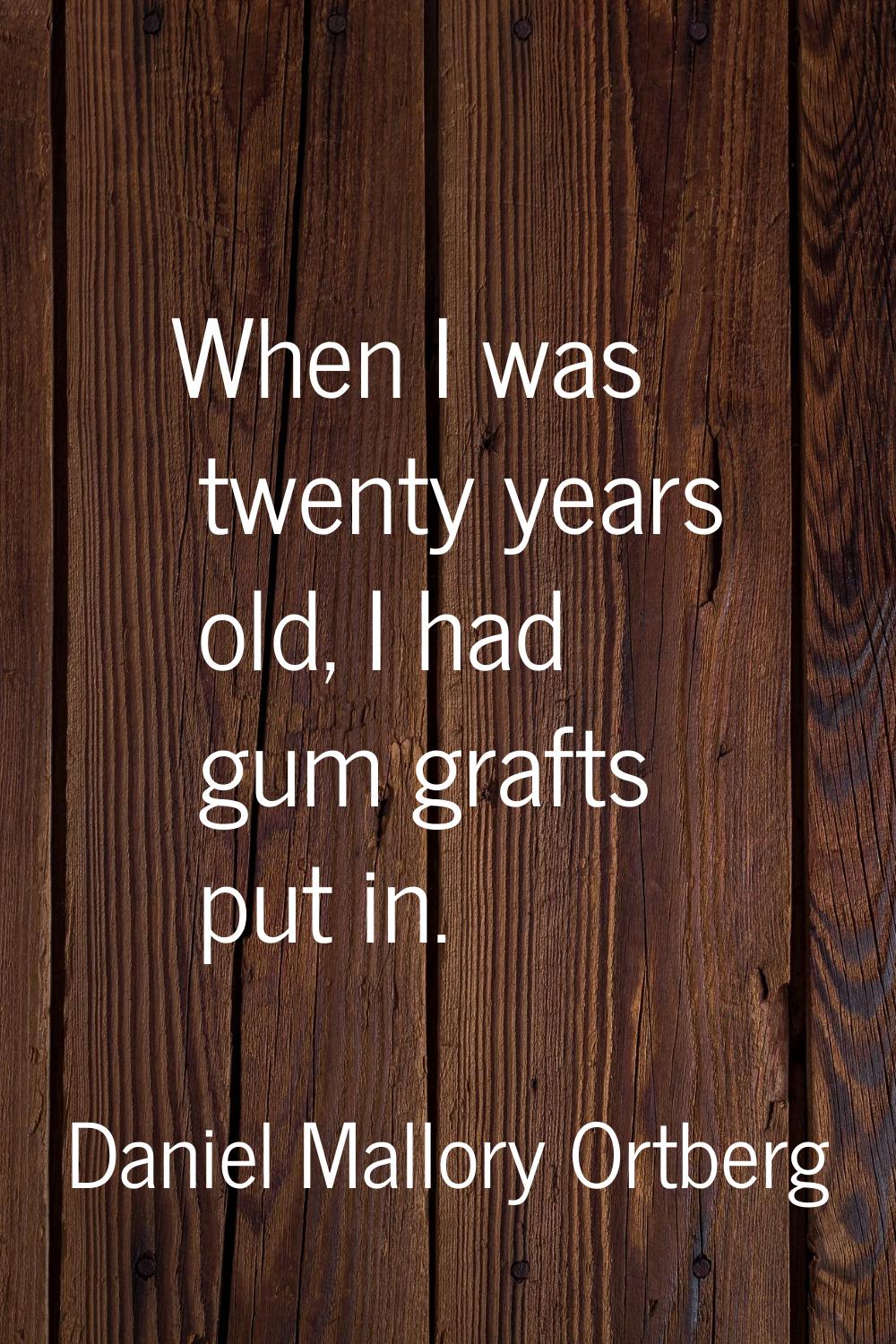 When I was twenty years old, I had gum grafts put in.