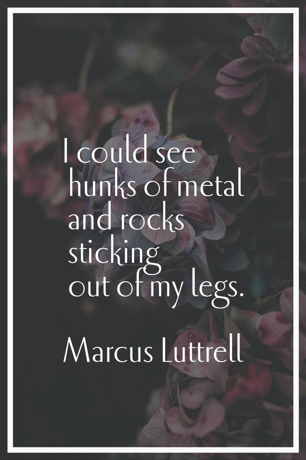 I could see hunks of metal and rocks sticking out of my legs.