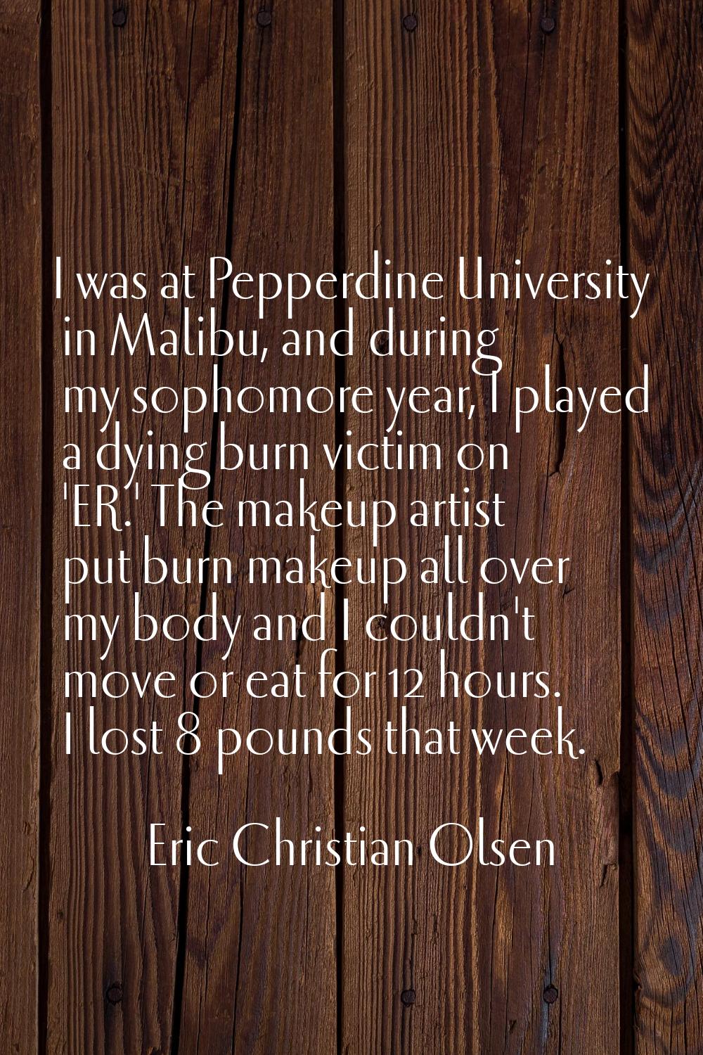 I was at Pepperdine University in Malibu, and during my sophomore year, I played a dying burn victi