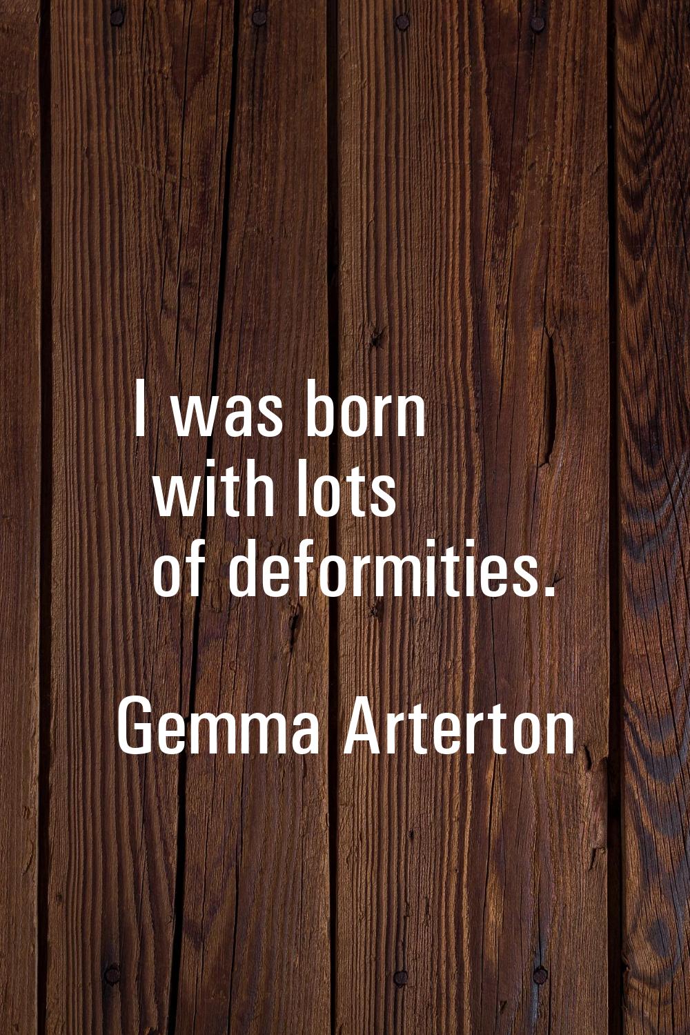 I was born with lots of deformities.
