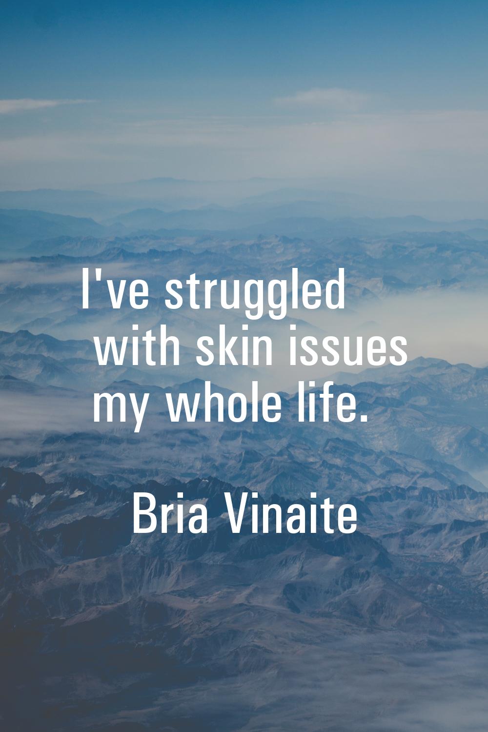I've struggled with skin issues my whole life.