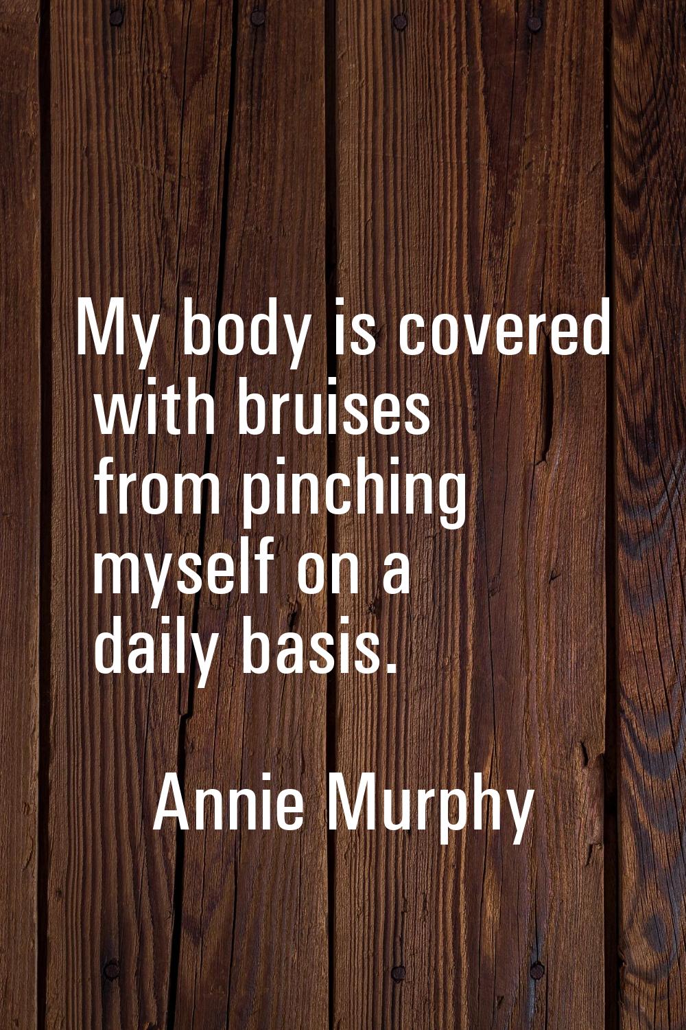 My body is covered with bruises from pinching myself on a daily basis.