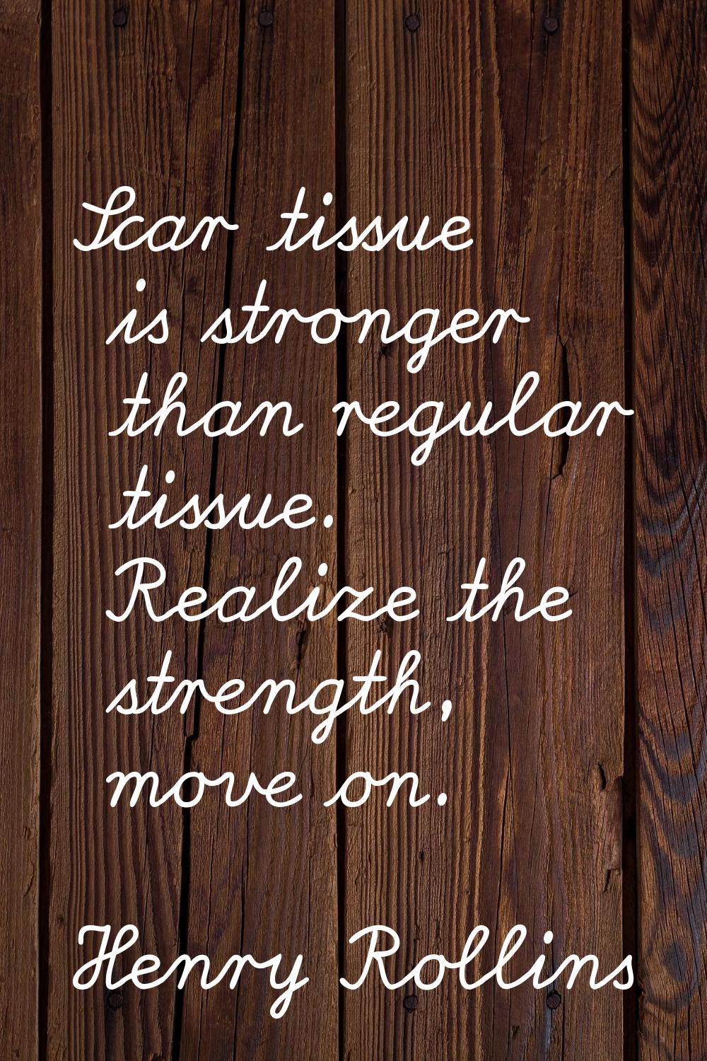Scar tissue is stronger than regular tissue. Realize the strength, move on.