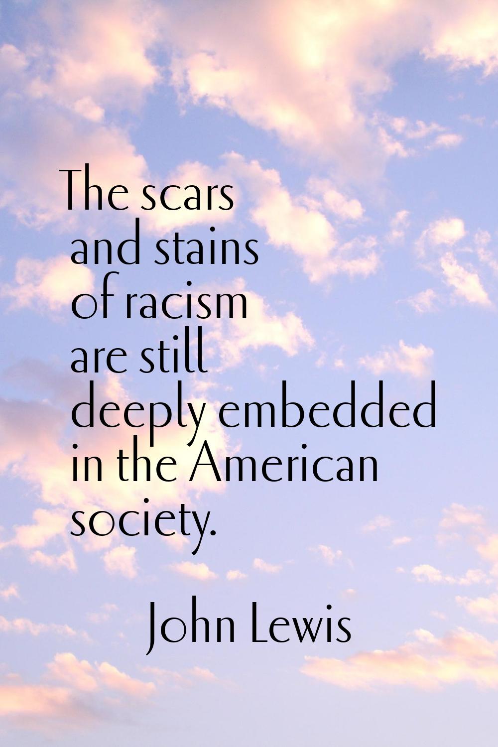 The scars and stains of racism are still deeply embedded in the American society.