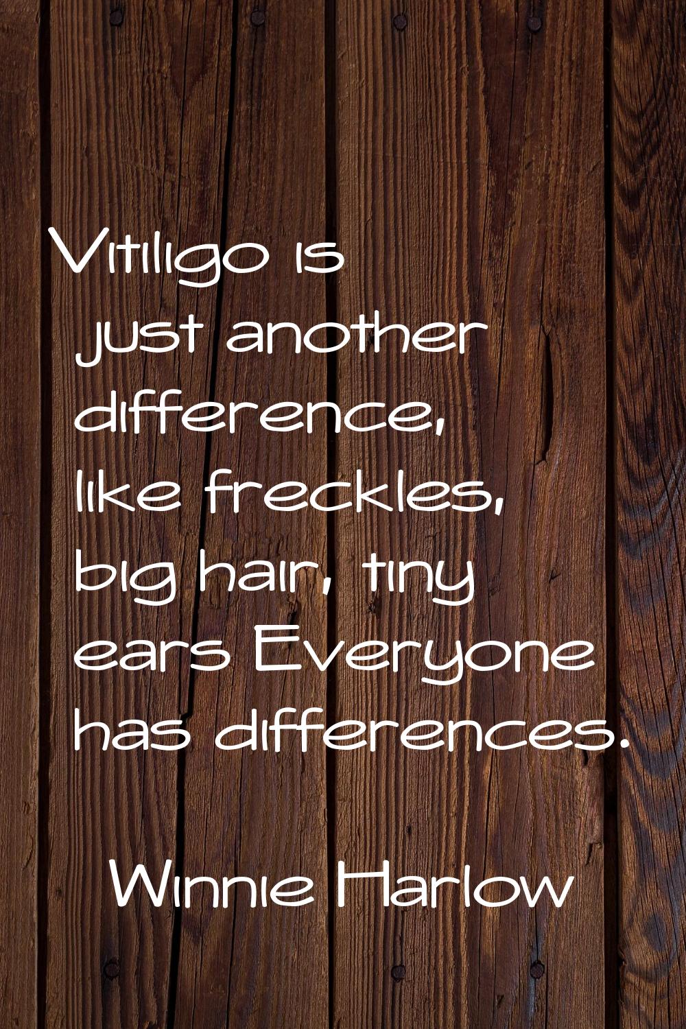 Vitiligo is just another difference, like freckles, big hair, tiny ears Everyone has differences.